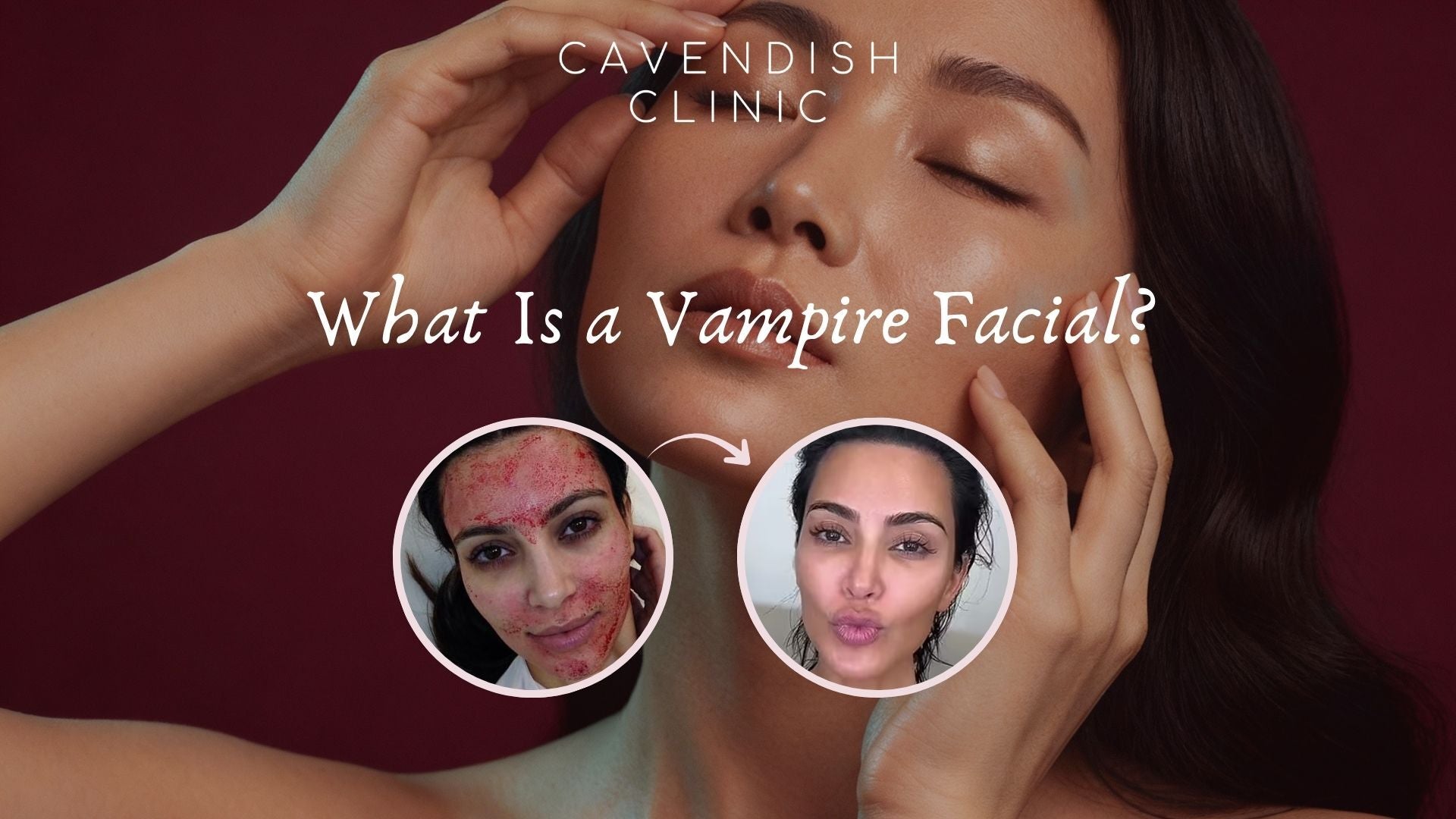Halloween Special: The Vampire Facial - Is PRP the Secret to Younger-Looking Skin?