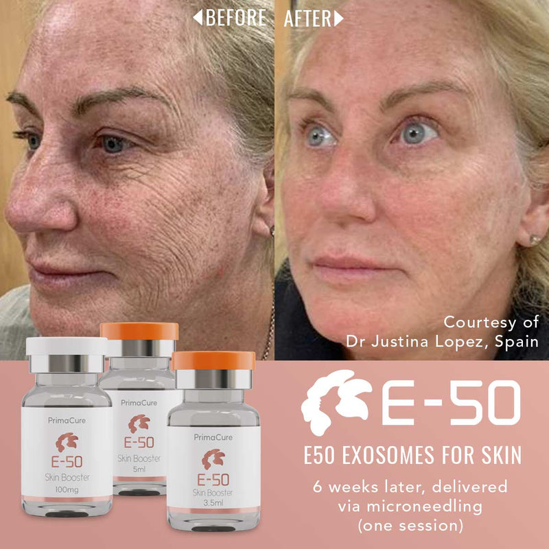Exosome Skin Rejuvenation