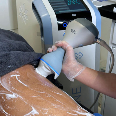 EmTone Cellulite Reduction