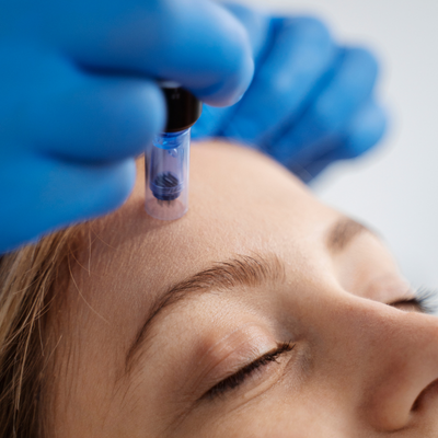 Exosomes Therapy