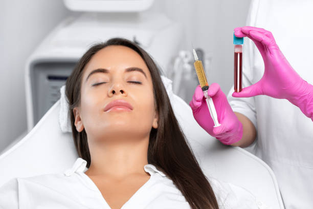 PRP (Platelet-Rich Plasma) Skin Therapy