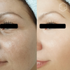 Anti-Wrinkle Treatments