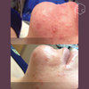 Hydrafacial Platinum (New)