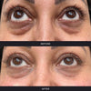 Polynucleotides (Face & Under Eyes)