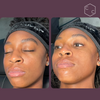 Hydrafacial Platinum (New)