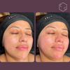 Hydrafacial Platinum (New)
