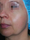 facetite - Before