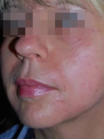facetite - After