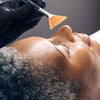 Skin Peels