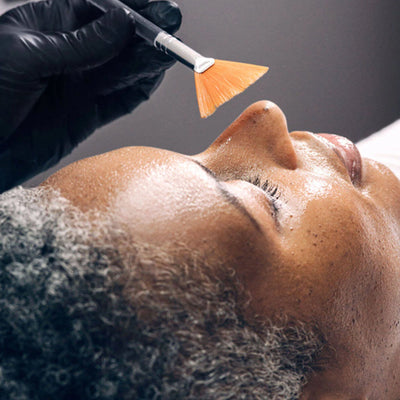 Skin Peels