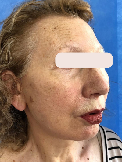 Before & After - After
