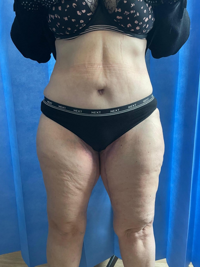 Before & After - After