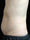 emsculpt - After