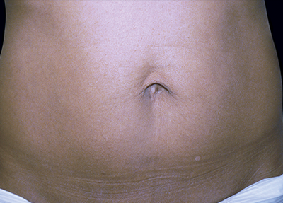 exilis - After