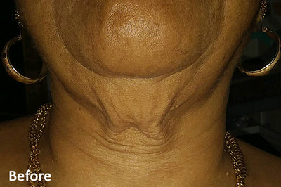 Forma - Before