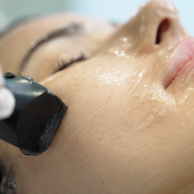 Forma Radiofrequency Skin Tightening