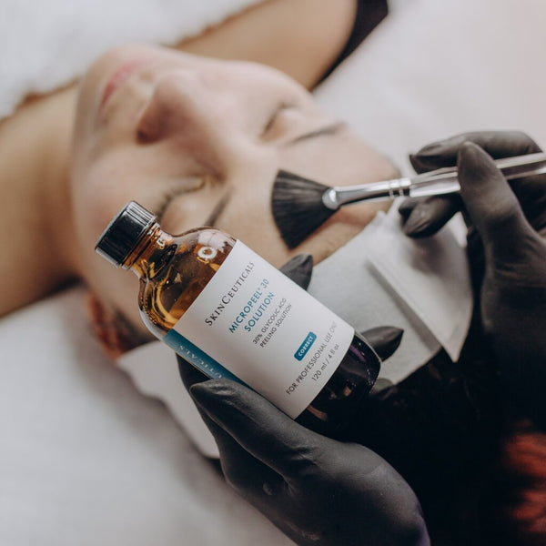 Skin Peels