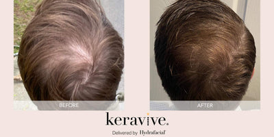 Hydrafacial Keravive