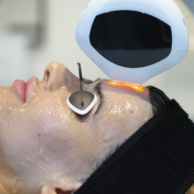 Lumecca IPL (Intense Pulsed Light)