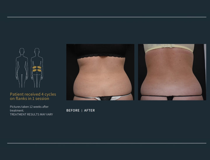 Body Contouring Specialists