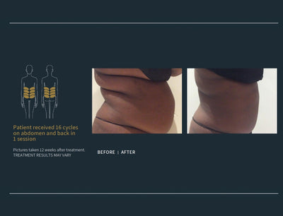 Body Contouring Specialists