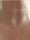 laser genesis 2 - Before