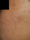 laser genesis 3 - After