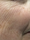 laser genesis - Before