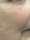 laser genesis - After