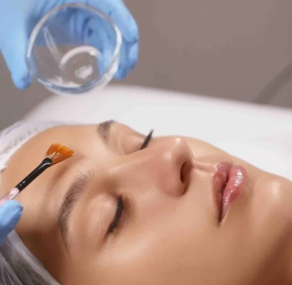 Skin Peel Treatment at Cavendish Clinic