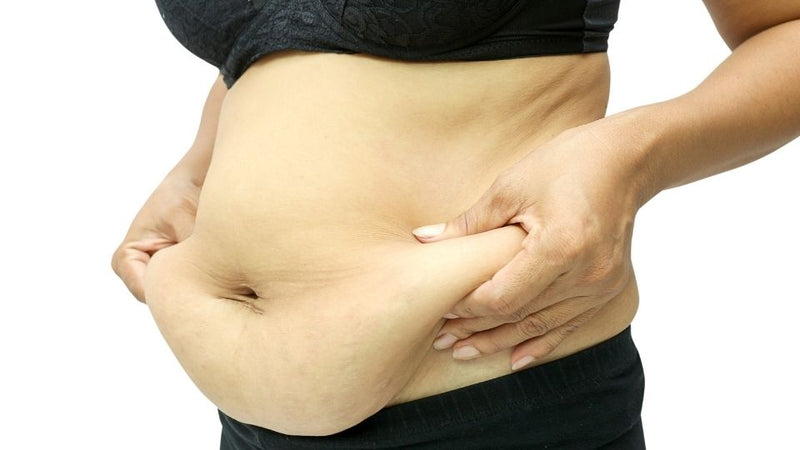 Why consider post-weight loss surgery?