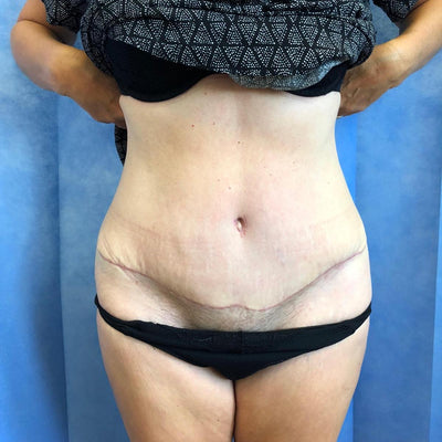 Before & After - After