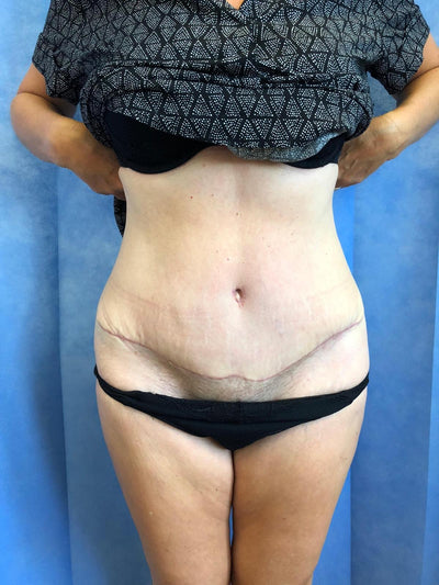 Before & After - After