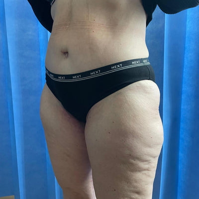 Before & After - After