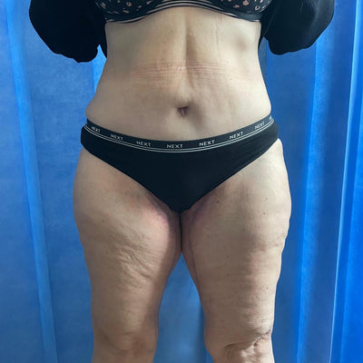 Before & After - Before
