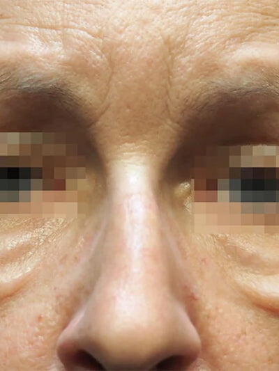 morpheus 4 - Before