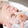 Skin Peels