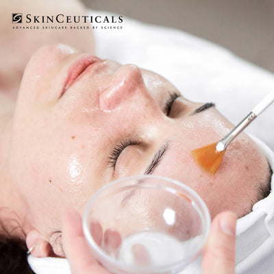 Skin Peels