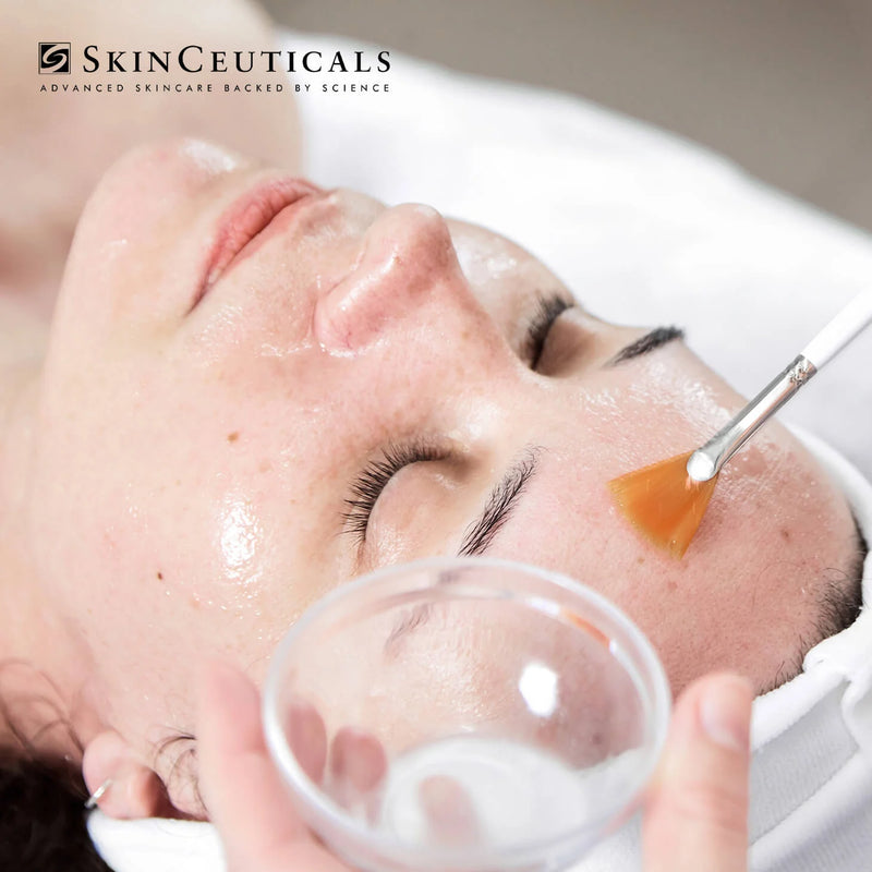 Skin Peels