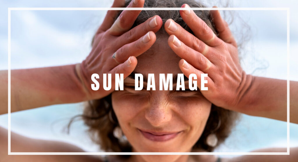 Sun-Damage