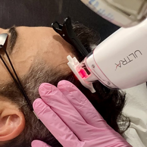 LaseMD Keralase: Hair Growth & Strength with Laser Therapy
