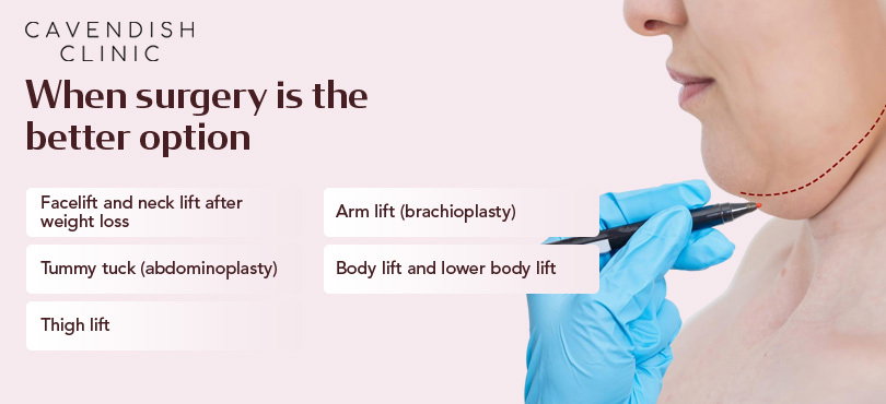 When surgery is the better option