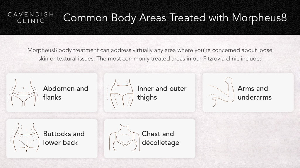 Common Body Areas Treated with Morpheus8