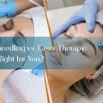 RF-Microneedling-vs.-Laser-Therapy