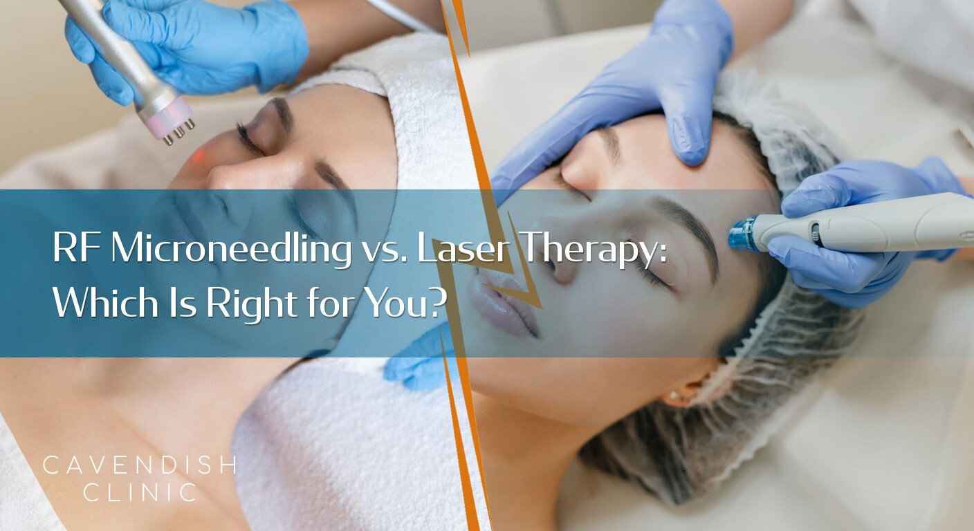 RF-Microneedling-vs.-Laser-Therapy