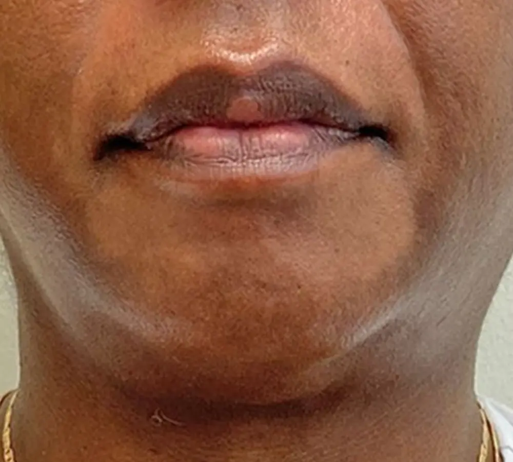 6a