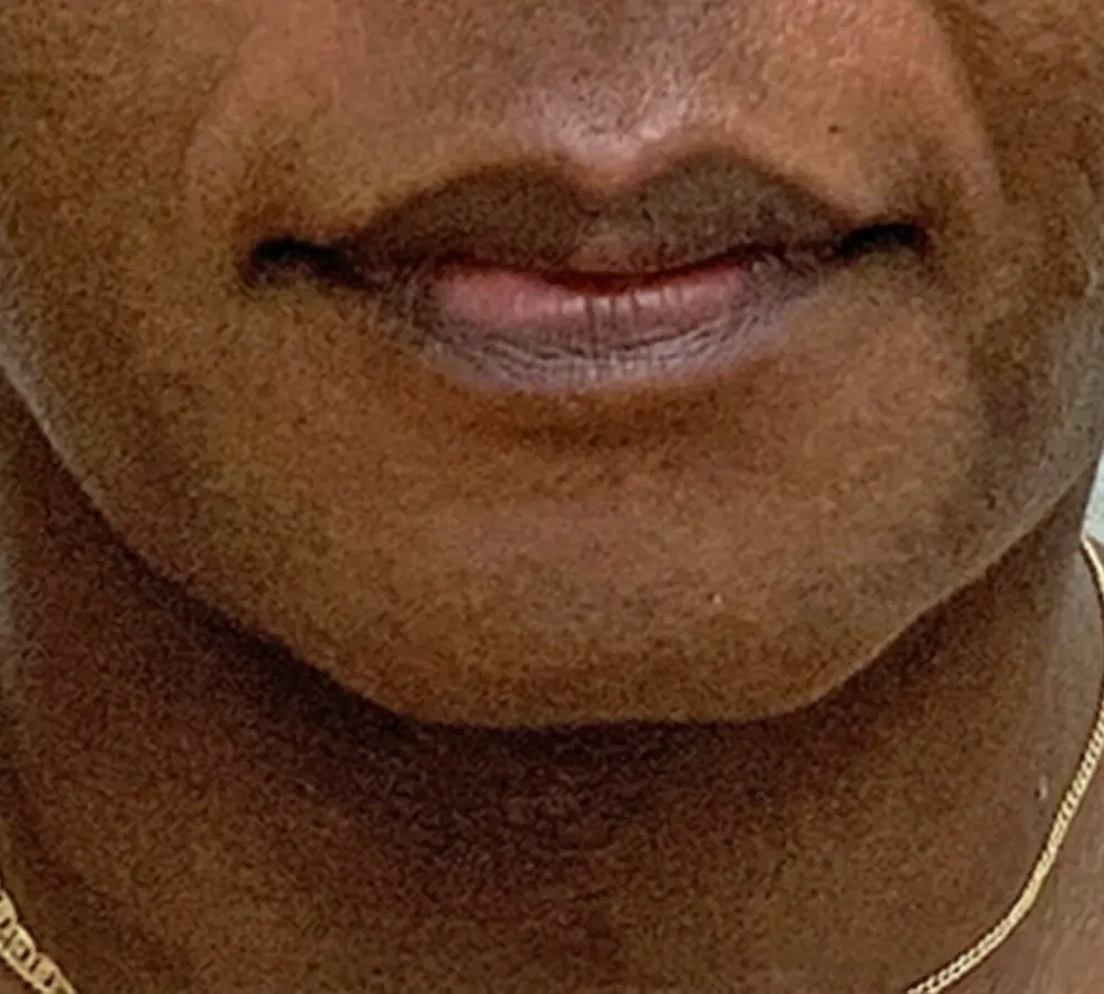 6b
