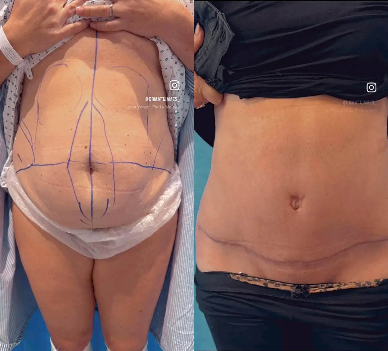 Surgery Client B Before After