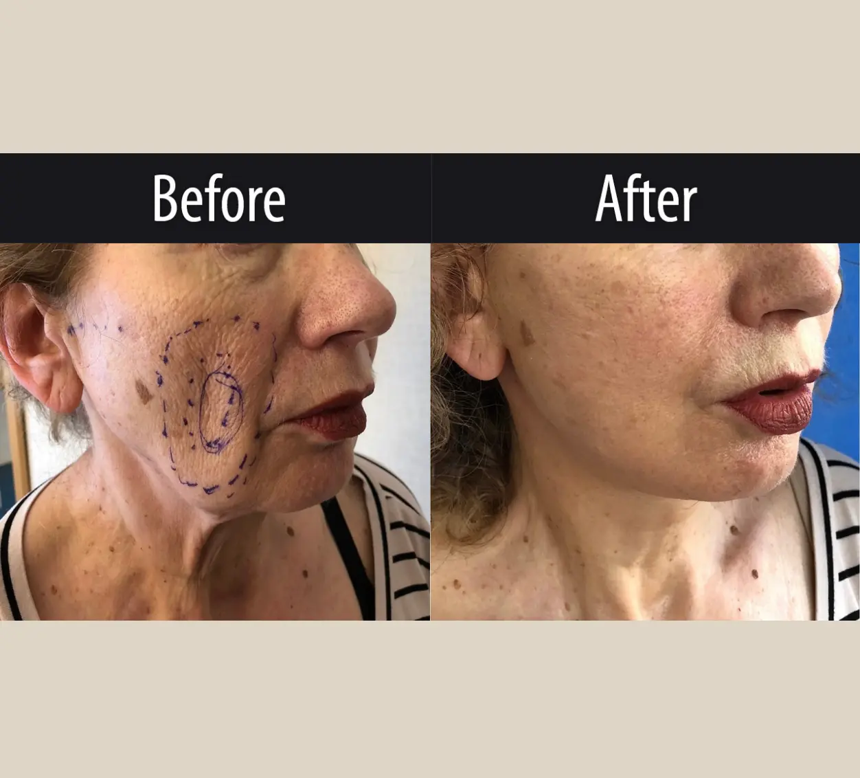Surgery Client J Before After