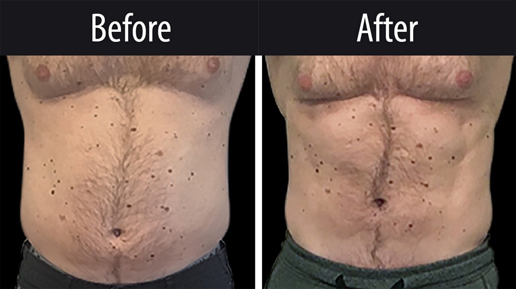 What Results Should You Actually Expect?